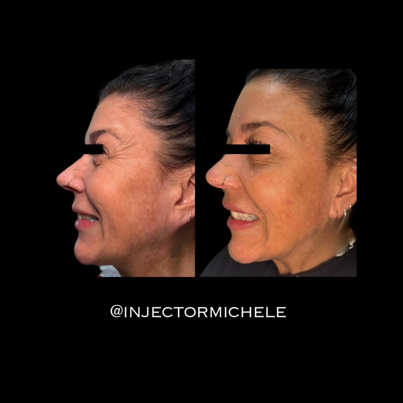 Michele's original paired crow’s-feet photographs with both eye privacy masks preserved.