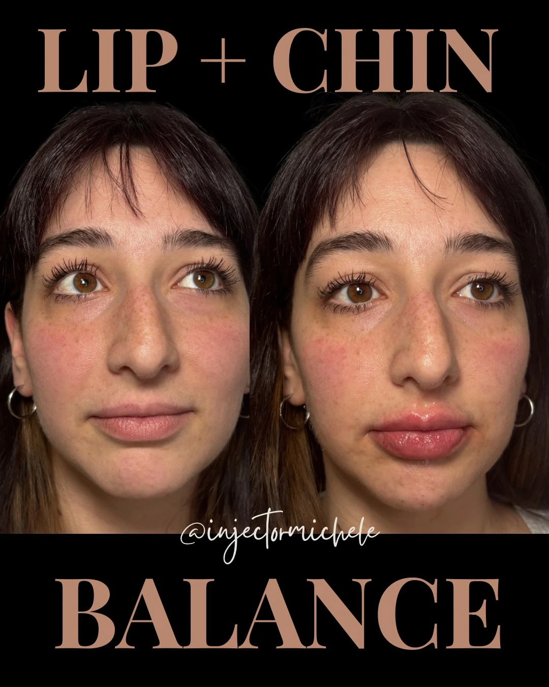 Michele's original paired lip-and-chin balancing photographs, presented together without cropping.